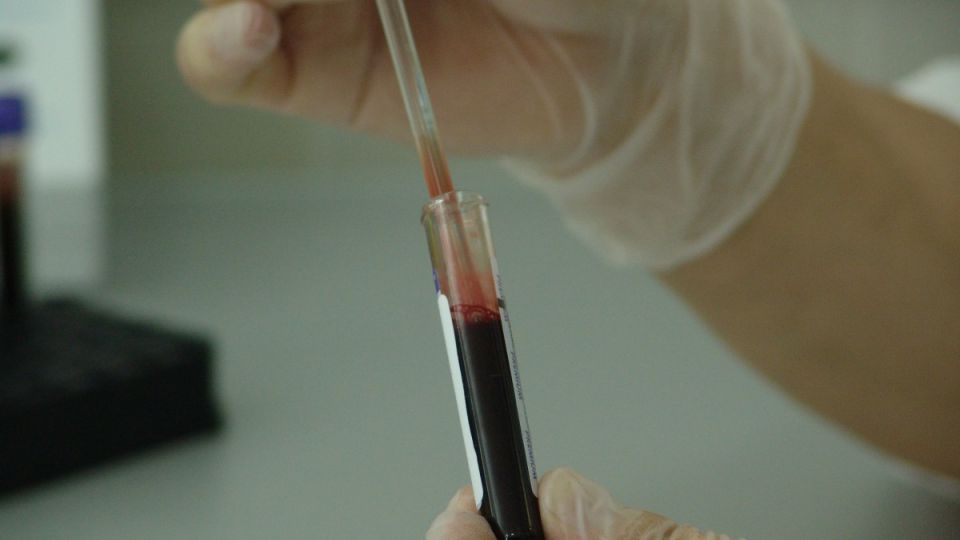 Употребление шести продуктов и напитков предотвратит тромбоз Употребление шести продуктов и напитков предотвратит тромбоз