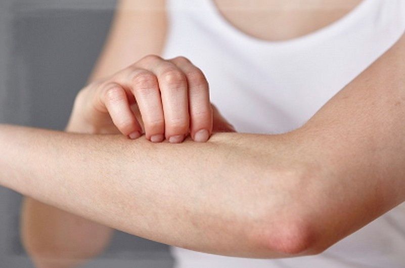 Почему зуд в коже может быть первым сигналом о серьезном заболевании