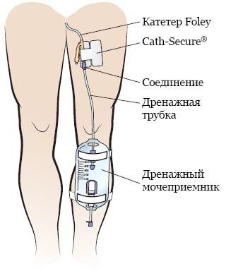 У Трампа во время ходьбы заметили торчащий из штанов мочесборник, примотанный к ноге У Трампа во время ходьбы заметили торчащий из штанов мочесборник, примотанный к ноге
