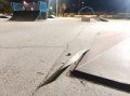 Ребенок рассек ногу металлом на скейт-горке в Забайкалье